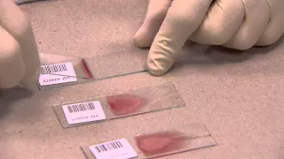 IDEXX - How to make a Blood Film in 3 steps