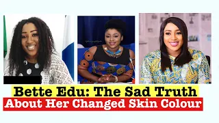 Edu Bette's Skin Getting Lighter As She Got Higher In Politics: The Sád Truth Revealed