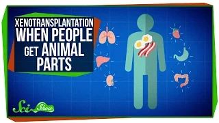 Xenotransplantation: When People Get Animal Parts