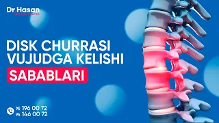 Disk churrasi (grija) vujudga kelish sabablari... | Doctor Hasan Medical Center