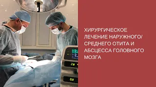 Хирургическое лечение наружного и среднего отита, а также абсцесса головного мозга.