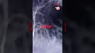 Two Bigfoot caught on live camera