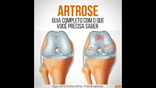 Artrose.