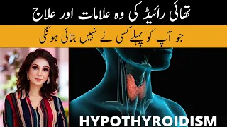 Hypothyroidism: Symptoms & Treatment In Urdu Hindi - Thyroid Ki Alamat Or  Ilaj - Dr Sahar Chawla