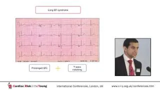 Cardiac Evaluation of Athletes