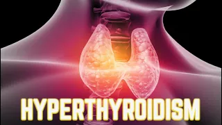 Hyperthyroidism (updated 2023) - CRASH! Medical Review Series