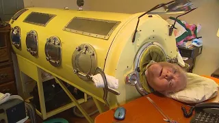 Family remembers Paul Alexander, a Dallas man who lived in an iron lung for 70-plus years