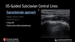 Ultrasound-Guided Subclavian Lines