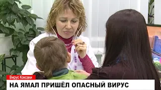 На Ямале зарегистрированы случаи заболевания вирусом Коксаки.