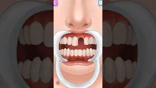 Why Grinding Your Teeth Is Bad😬!!! #shorts #short #trending #viral #viralvideo