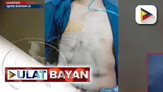 Isang taxi driver, sugatan matapos barilin ng isang negosyante sa Quezon City