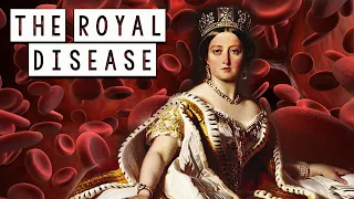 The Royal Disease - How Queen Victoria spread this disease across European courts (Hemophilia)