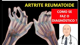 O DIAGNÓSTICO DA ARTRITE REUMATOIDE: sintomas, laboratório e radiografias