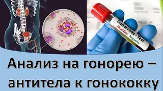 Анализ на гонорею - антитела к гонококку