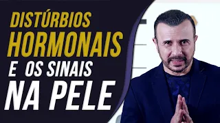 Distúrbios hormonais e os sinais na pele | Dr Italo Rachid