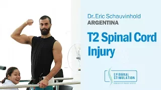 Great Progress Seen After Epidural Stimulation for T2 Spinal Cord Injury Patient Eric from Argentina