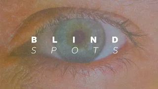 Blind Spots - Pastor Paul Scanlon (March 19, 2017)