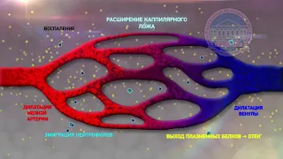 M053   Воспаление