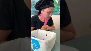 Hijama.pro__ кровопускания с лба +7-925-571-07-77