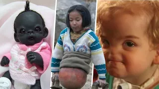 10 Increíbles NIÑOS Que Son ÚNICOS En El Mundo *NO CREERAS Que EXISTEN 😲