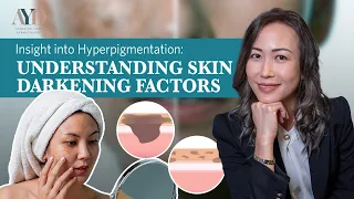 Understanding Hyperpigmentation