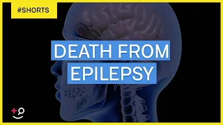 Can You Die From Epilepsy?  #Shorts