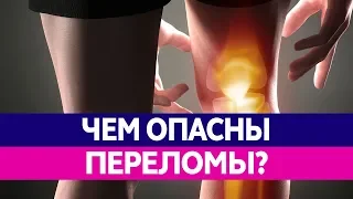 ЧЕМ ОПАСЕН ПЕРЕЛОМ КОСТЕЙ? Лечение переломов и их последствия!