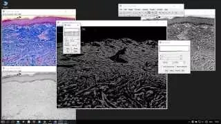 ImageJ : Measuring Areas of Histological sections