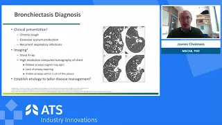 A Deep Dive into the “I”s of Non-cystic fibrosis bronchiectasis