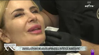 Daniela Gyorfi ne arată operațiile estetice nereușite!