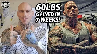Martyn Ford Gained 60 Pounds Of Muscle In 7 Weeks After The Surgery
