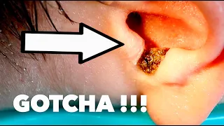FUN EARWAX REMOVAL (He Could Barely Hear Before We Started) | Dr. Paul
