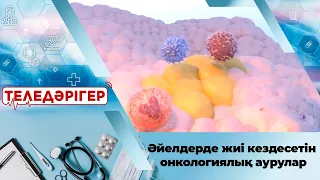 Әйелдерде жиі кездесетін онкологиялық аурулар. «Теледәрігер»