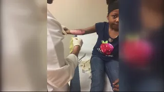 Family sues after girl suffers severe burns at school
