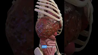 Understanding Liver Cirrhosis: Key Facts  #anatomy #meded #3dmodel