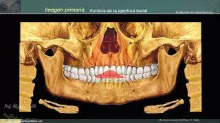 Estructuras anatómicas en la radiografía panorámica II