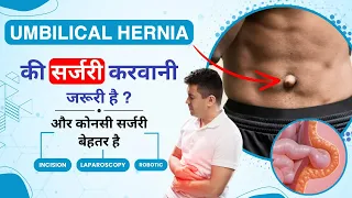 What is Umbilical Hernia in Hindi | Umbilical Hernia - Causes, Recovery, Symptoms & Treatment