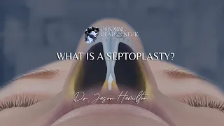 What is a septoplasty?