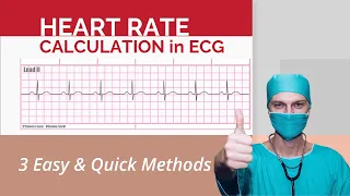 3 Easy Methods to Calculate Heart Rate on ECG - Quick & Simple