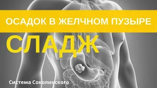 Сладж в желчном пузыре. Густая желчь. Как растворить? Холестаз