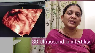 3D ultrasound in infertility