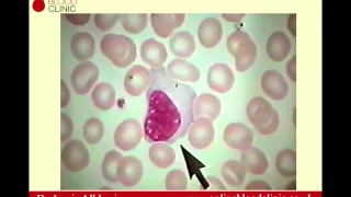 Morphology Review