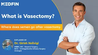 What is Vasectomy