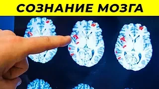 Исследователи Нашли Доказательство Сознания После Смерти