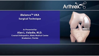 iBalance® UKA Surgical Technique