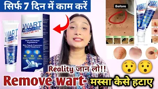 Wart Remover cream|wart remover ointment @Meesho |instant Blemish Removal|मस्सा कैसे हटाए|2023