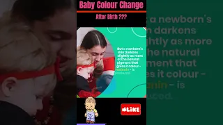 **Baby Colour Change** After Birth #shorts | How to Improve **Baby Skin **Colour #youtubeshorts |