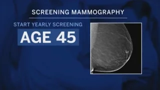 New Guideline for First Screening Mammogram for Women with Average Breast Cancer Risk