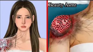 Asmr Replace Spider And Several Replace Injured Animation