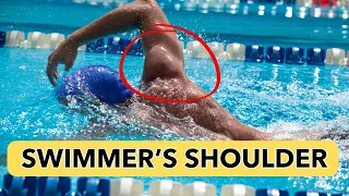 Swimmer's Shoulder: Top 3 Exercises to Stop It (In Pool Exercises)